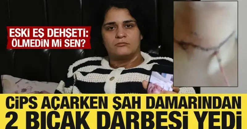 Cips paketini açarken boğazını kesti! Ayrıldığı eşi dehşeti yaşattı: Ölmedin mi sen?