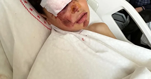 Otomobiliyle 12 yaşındaki bisikletliye çarpıp kaçtı, o anlar kamerada Aksaray Haberleri