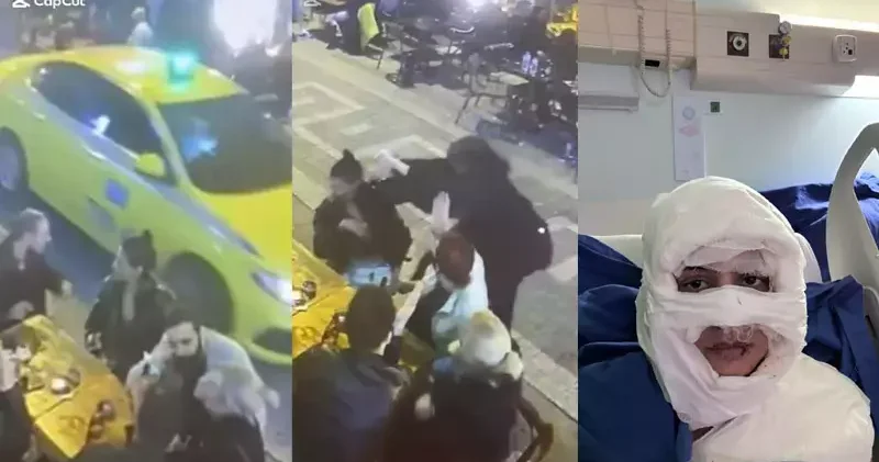 Kadıköy de kadının üzerine yanıcı madde attıp kaçtı