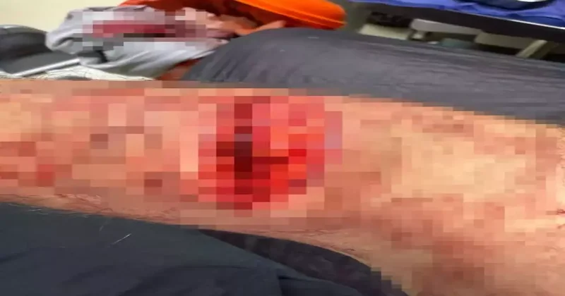 Başakşehir de sahipli köpek dehşeti! Site güvenliği hastanelik oldu