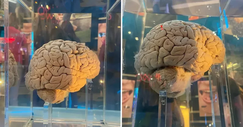 Amsterdam daki dev arşiv: 5 bin 300 beyin yapay zeka ile haritalanacak