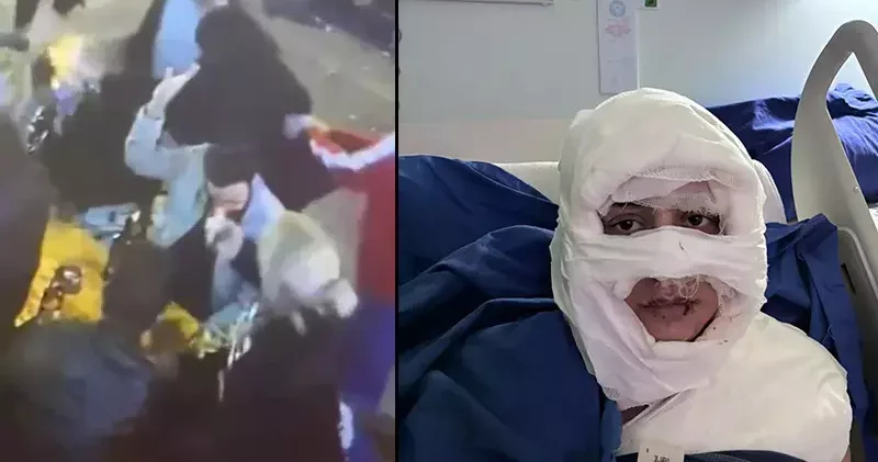 Kadıköy de kadının üzerine yanıcı madde atan sanığa 4 yıl 6 ay hapis talebi