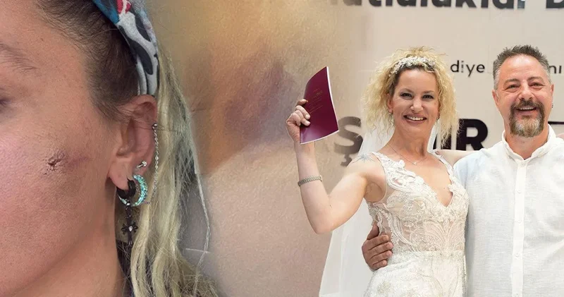 Yıldız Asyalı darp edildim diyerek paylaşmıştı: Eşi sessizliğini bozdu