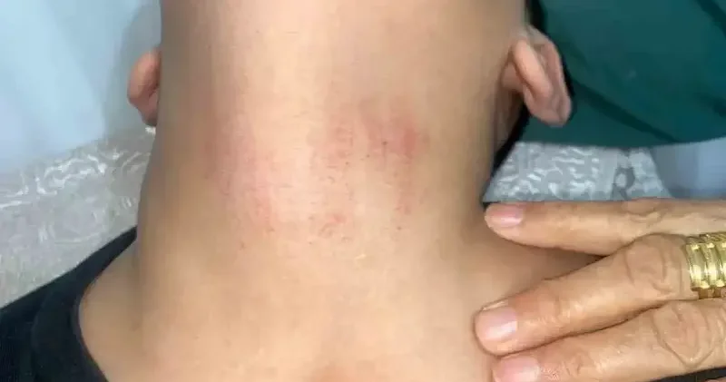 Okulda bayrak tartışması: 10 yaşındaki öğrenciye darp iddiası İstanbul Haberleri