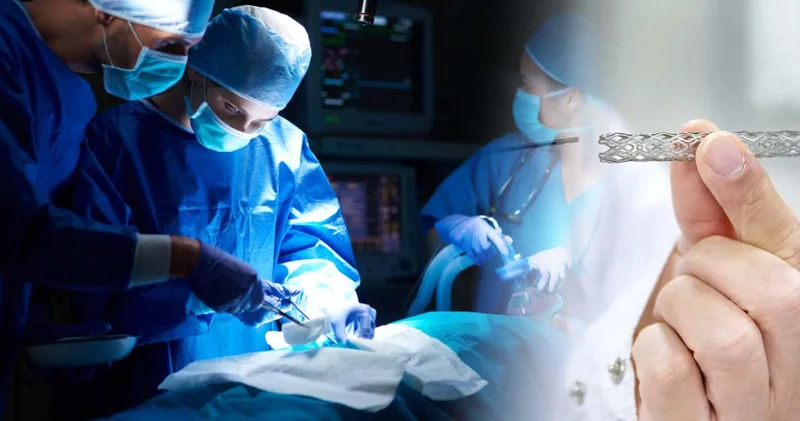 Tarihi geçmiş stent skandalını kürsüde bir bir anlattı: Kabul edilmez bir kamu zararı