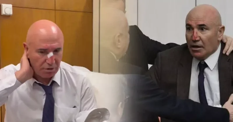 Meclis teki yumruklu kavgada CHP li Tanal ın burnu kanadı! İlk müdahale revirde yapıldı