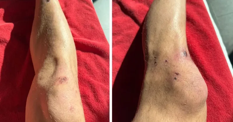 Galatasaray paylaştı: Tarihi zaferin bedeli