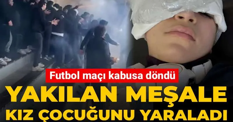 Futbol maçı kabusa döndü! Yakılan meşale kız çocuğunu yaraladı: Gözünde hasar oluştu