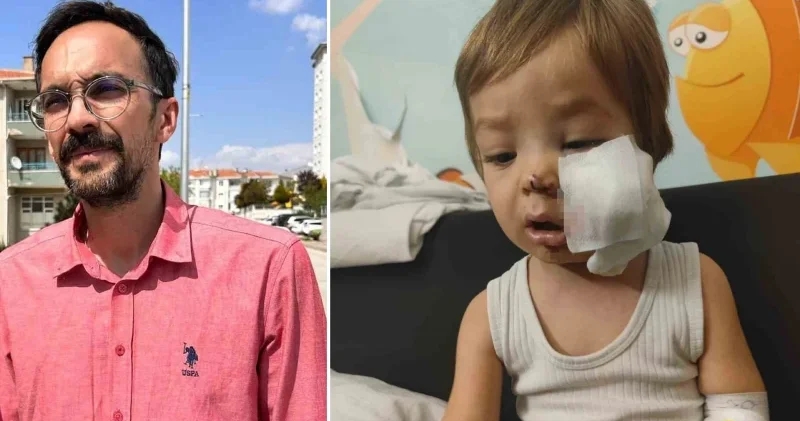 Ankara’da iki çocuğu pitbull saldırısına uğradı: Köpek sahibi yaraları iyileşmeden serbest bırakıldı Ankara Haberleri