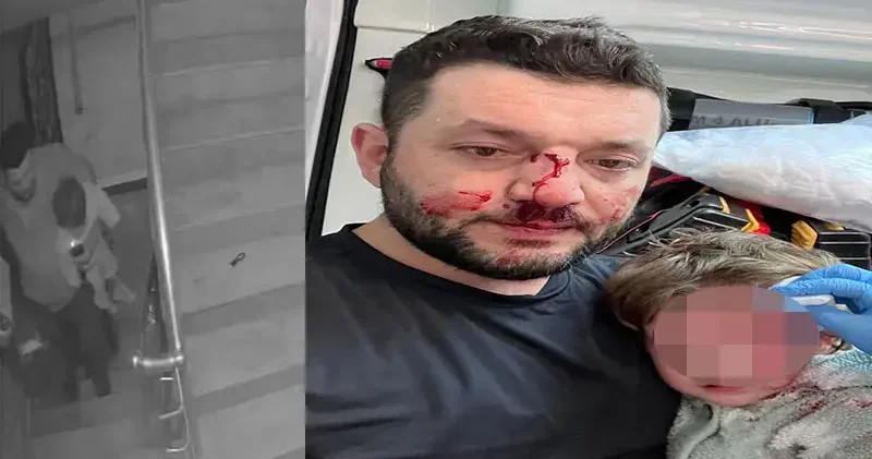 Kucağında bebeği olan babayı darbeden şüpheli adli kontrolle tahliye edildi