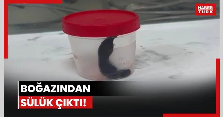 Boğazından sülük çıktı!