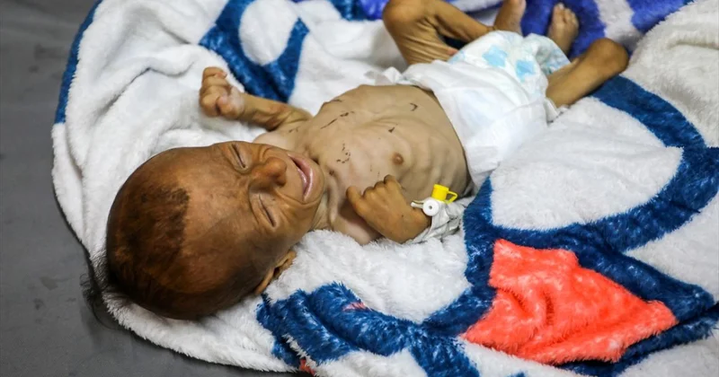 Gazze deki hasta çocuklar, umutsuzca yurt dışında tedavi olacakları günü bekliyor