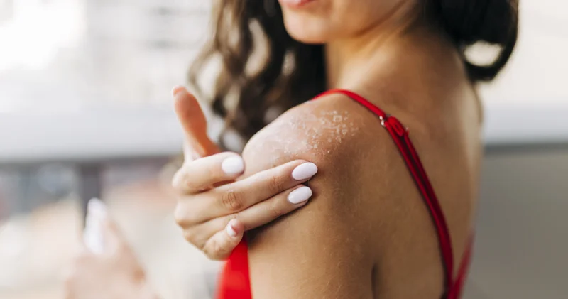 Çatlayan dudaklar, kuruyan eller... Kış aylarının cildinize zarar vermesini engellemenin yöntemleri