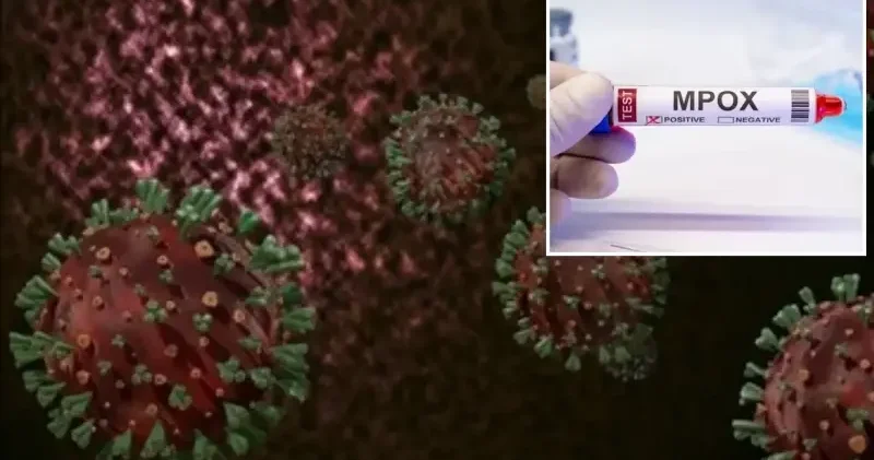 Madagaskar’da M çiçeği alarmı: Vaka sayısı 20’ye ulaştı Dünya Haberleri