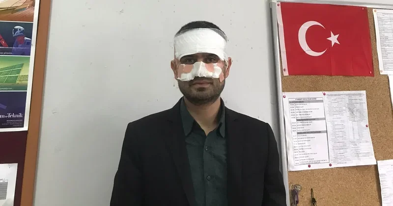 Eskişehir’de dehşete düşüren olay Lisede öğretmene zorbalık: Yüzüne sıcak çay fırlattı!