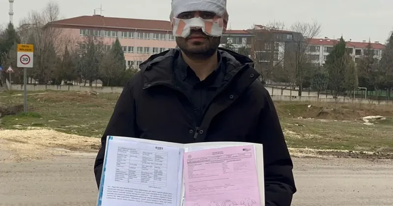 Rehber öğretmenin yüzüne sıcak çay fırlattığı fizik öğretmeni feci şekilde yandı