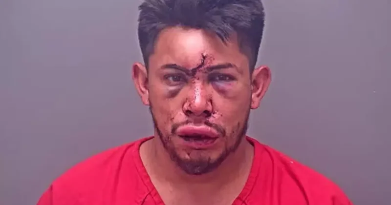 13 yaşındaki çocuk, babasını bu hale getirdi