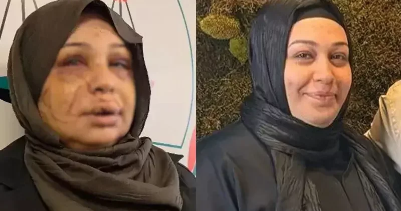 Eşini yaralayan polis memurunun dosyası, ağır cezaya gönderildi