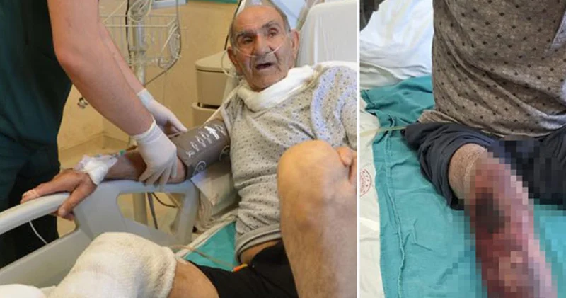 SON DAKİKA: Herkesin başına gelebilir... Tıkalı lavaboyu açacaktı! Kimyasal yanık Son dakika haberleri