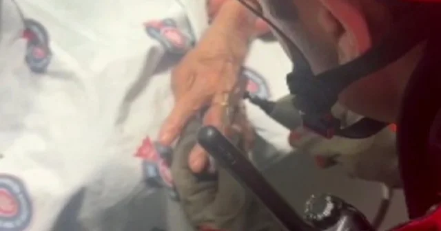 Hastanın parmağına sıkışan yüzüğü itfaiye ekipleri çıkardı Kahramanmaraş Haberleri