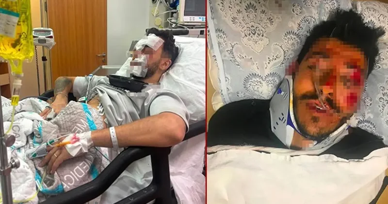Beylikdüzü nde feci kaza! Çok sayıda yaralı var