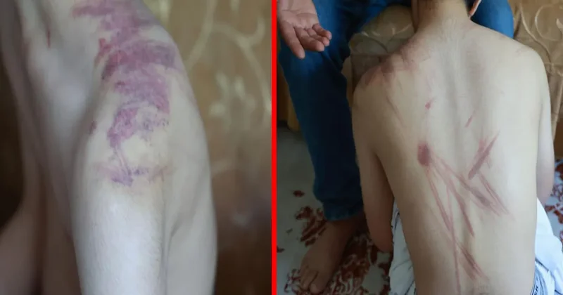 Elazığ da kan donduran olay! 14 yaşındaki engelli çocuğa şiddet: Acılı baba soluğu adliyede aldı