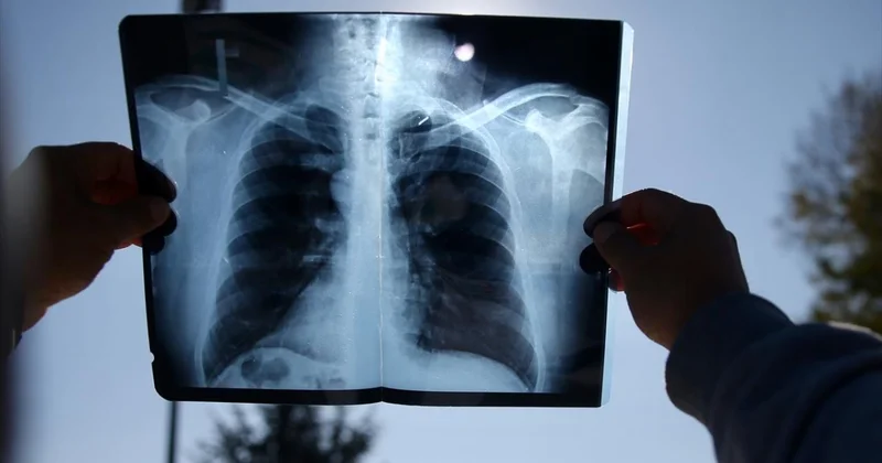 İspanya 114 yıl sonra ülkede ilk kez gözlemlenecek tam güneş tutulmasına hazırlanıyor