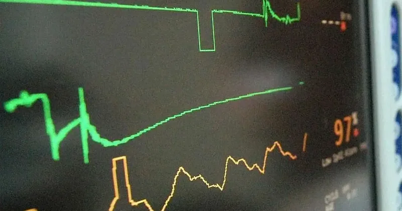 Kalp krizi artık gençleri de etkiliyor! İşte en sık görülen belirti