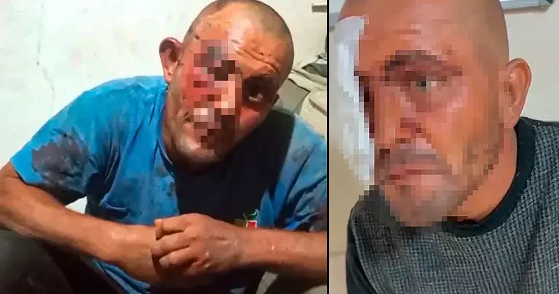 Sanal medyadaki videoları ile tanınan zihinsel engelli darbedildi