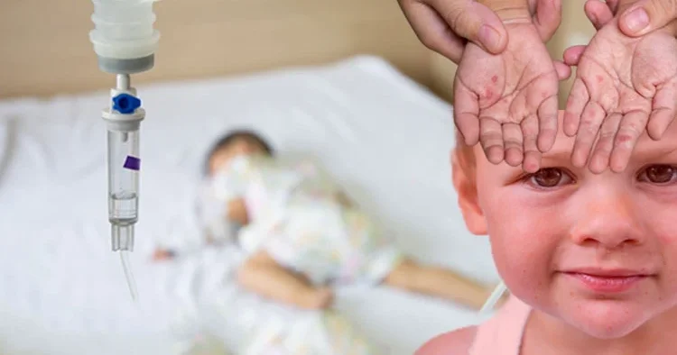 Hızla yayılan tehlike! Döküntü ve yüksek ateşle geliyor, bu hastalıklarla karıştırılıyor... Uzman isim alarm belirtileri anlattı