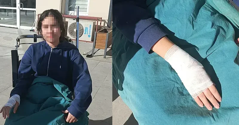 Sokak köpeklerinin saldırdığı çocuk yaralandı