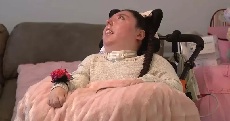 Beyinsiz doğan Alex 20 yaşında, doktorlar 5 yıl yaşamaz demişti