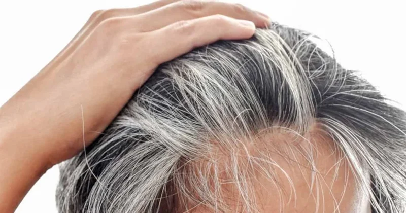 Yaşlılık belirtisi beyaz saç aslında bizi bu hastalıktan koruyormuş, riski gördüğü an pigment üretimini bırakıyor Sözcü Gazetesi