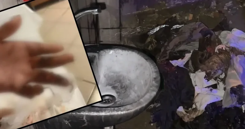 Kuaförde kabusu yaşadı, 14 yaşındaki Engin in tüm vücudu yandı: O anları anlattı