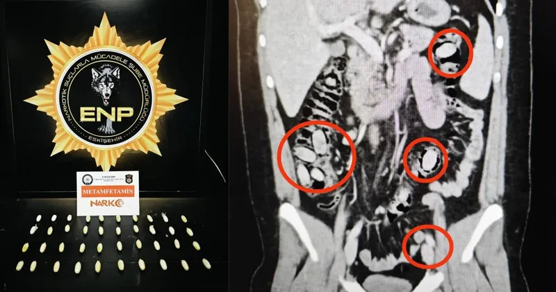 Midesinde sakladı: Kent girişinde yakalandı!