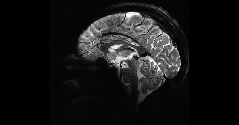 Beyne verilen elektrik akımı bencilliği azaltabilir mi?