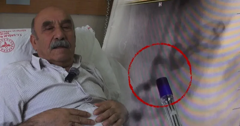 Göğüs yanması sandı, kalbinden kan çalan damar bulundu!