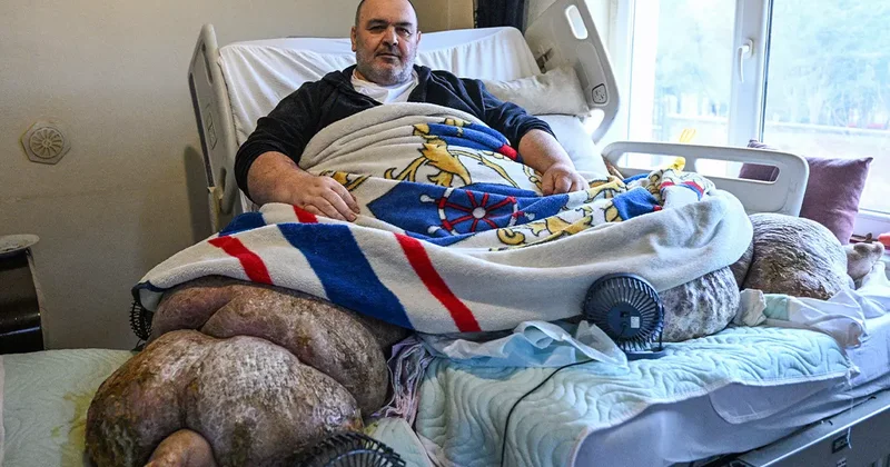 300 kiloya ulaşan fil hastası sevk edildi: Kapılar kırıldı, özel ekiple Ankara ya gönderildi