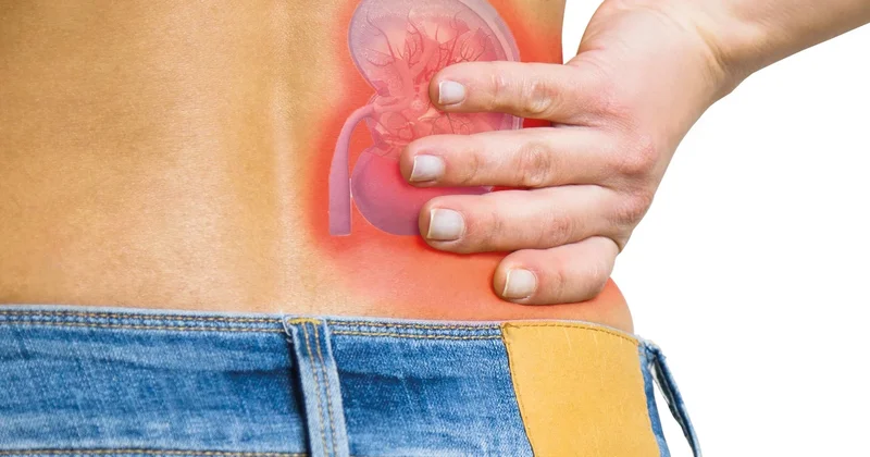 TBV’den dev böbrek maketli kampanya... Türkiye’de 72 bin diyaliz hastası var