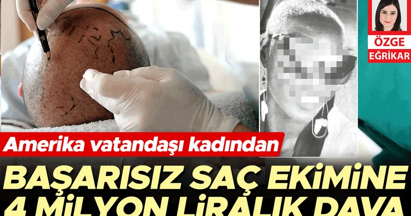 Başarısız saç ekimine 4 milyon liralık dava