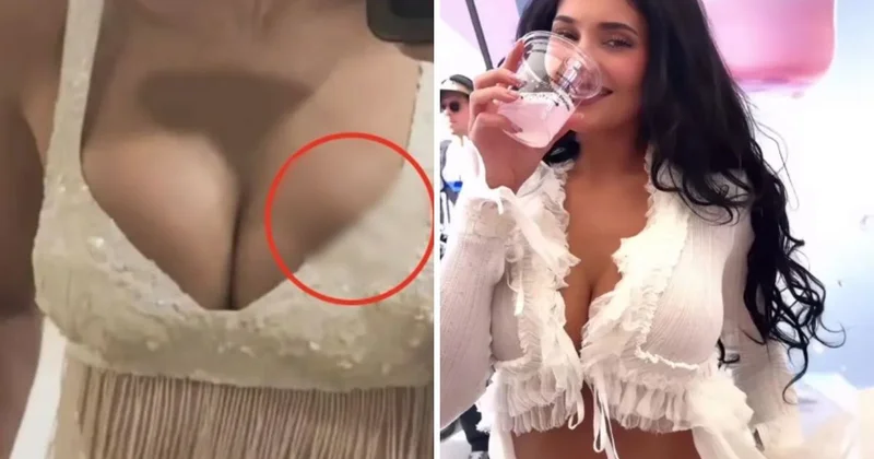 Milyonlarca hayranı bu sorunun cevabını arıyor: Kylie Jenner’ın silikonu mu patladı?