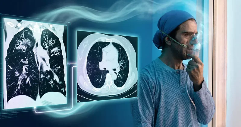 Dünyada en çok öldüren 4. hastalık: Akciğeri parçalıyor