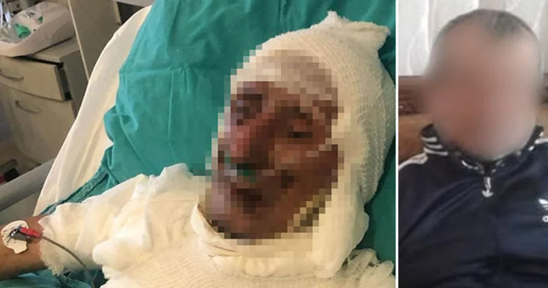 SON DAKİKA: Kardeş ağabeyi ateşe vermişti! İstenen ceza belli oldu Kastamonu haberleri Son dakika haberleri