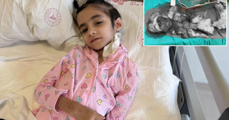Dünyada bir ilk! 3 kilogramlık tümör 6,5 saatlik operasyonla çıkarıldı