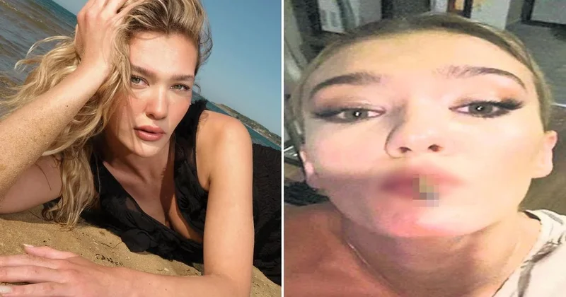 Uyuşturucu soruşturmasında Melisa Döngel in telefonundan çıkanlar şaşırttı: Acil lazım kanka