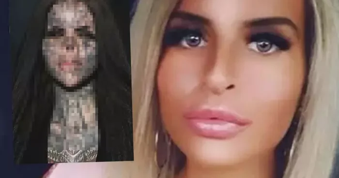 Bir gören bir daha baktı! Burnunu çıkartıp kavanozda saklıyor: Eski ve yeni haline kimse inanamadı