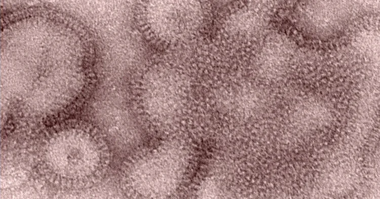 ABD de H3N2 virüsü endişesi: Farklı ülkelerde de görüldü! Salgın şiddetli olabilir