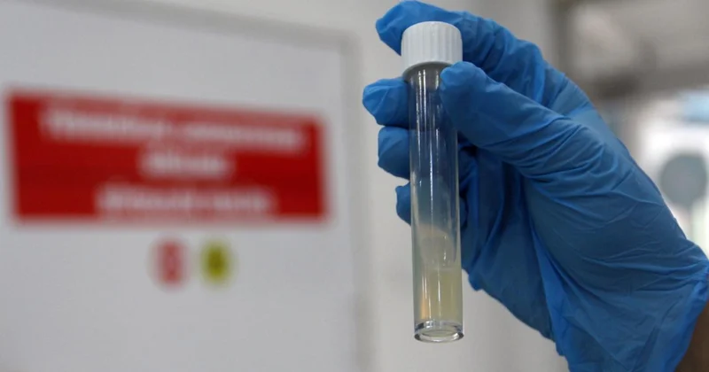 Dünyanın en ölümcül bulaşıcı hastalığı geçen yıl 1,23 milyon can aldı