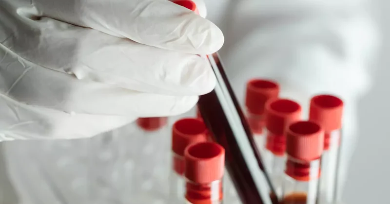 Dünyada sadece 50 kişide var! Altın kan ın sırrı çözülüyor: Bir damlası bile servet değerinde!