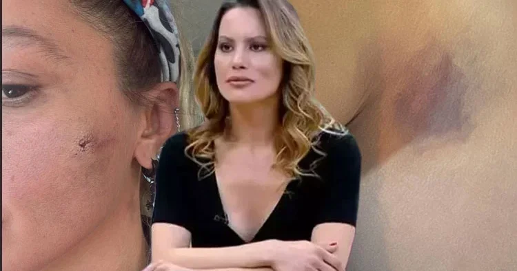 Yıldız Asyalı eşinden şiddet gördüğünü iddia etmişti... Korkuyorum